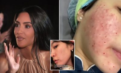 The truth behind Kim Kardashian's salmon sperm facial and the little known side effects of the $500 beauty treatment